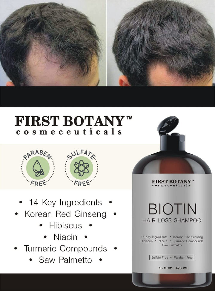 Cosmeceuticals, Hair Regrowth and Anti Hair Loss Shampoo 16 fl oz, with DHT blockers- Daily Hydrating, Detoxifying, Volumizing Shampoo For Men and Women