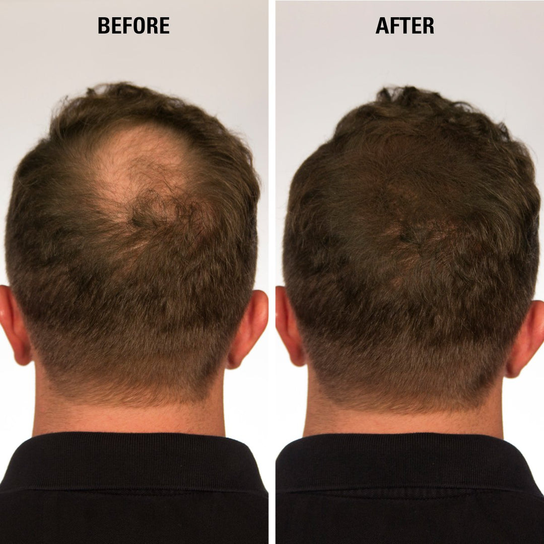 Instant Hair Filler 0.49 Oz EC-201 DARK BROWN