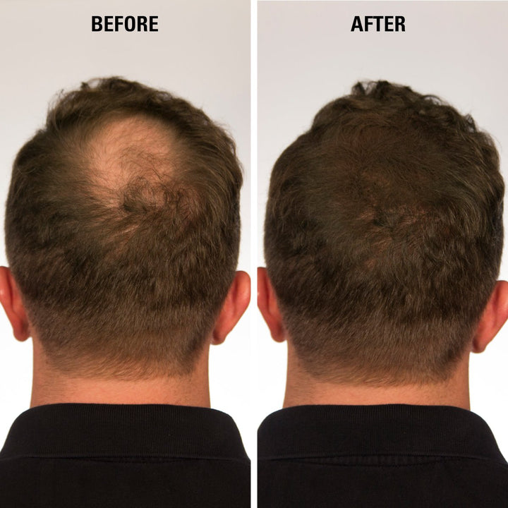 Instant Hair Filler 0.49 Oz EC-201 DARK BROWN