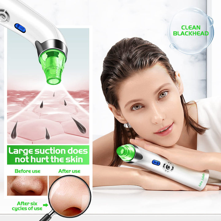 - Facial Pore Cleaner - Electric Acne Comedone Whitehead Extractor w/5 Suction Power 4 Probes, USB Rechargeable Blackhead Vacuum Removal Kit
