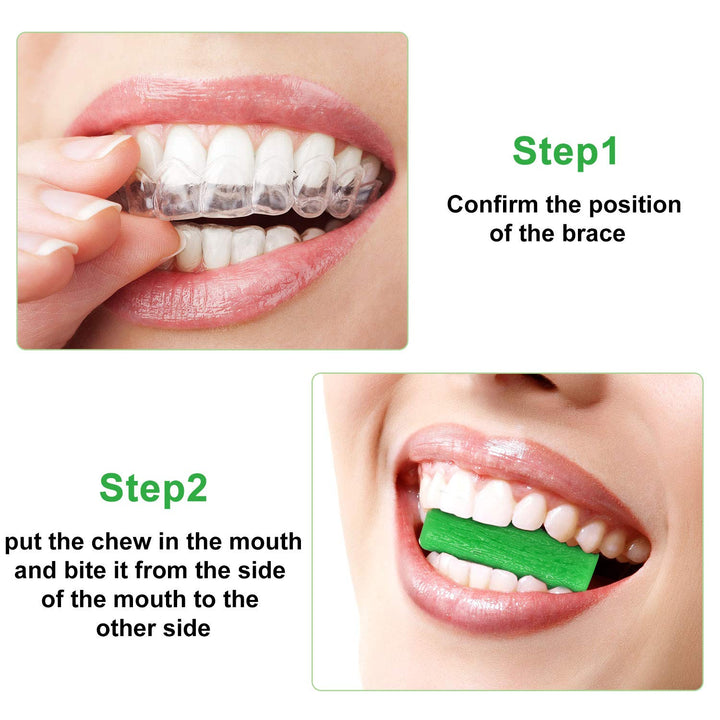 20 Pieces Aligner Tray Seaters Chewies for Aligner Trays Chompers Aligner Trays (Green)
