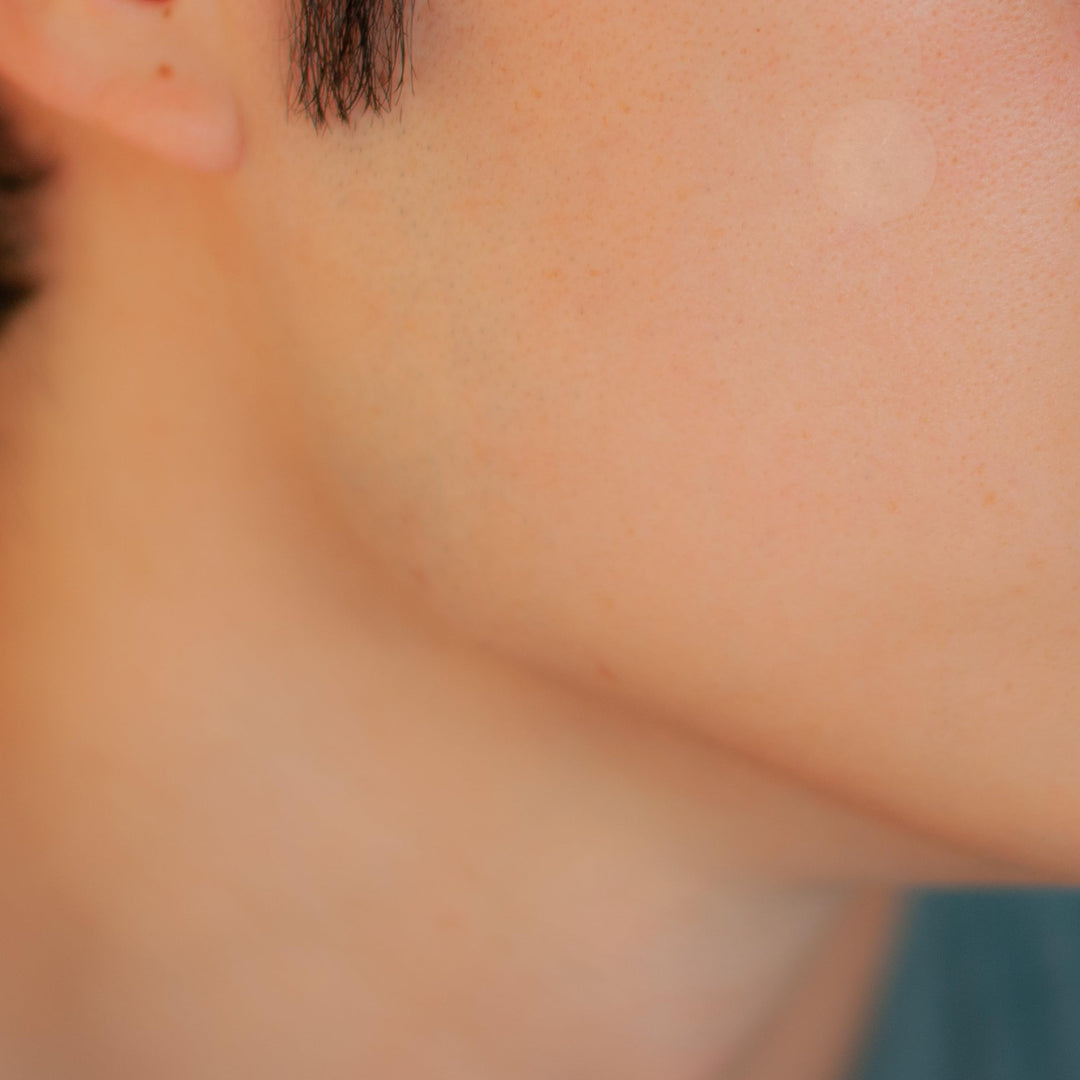 [Perforated] Cover-Dot Acne Care - Clear Acne Absorbing Patch - 24 dots