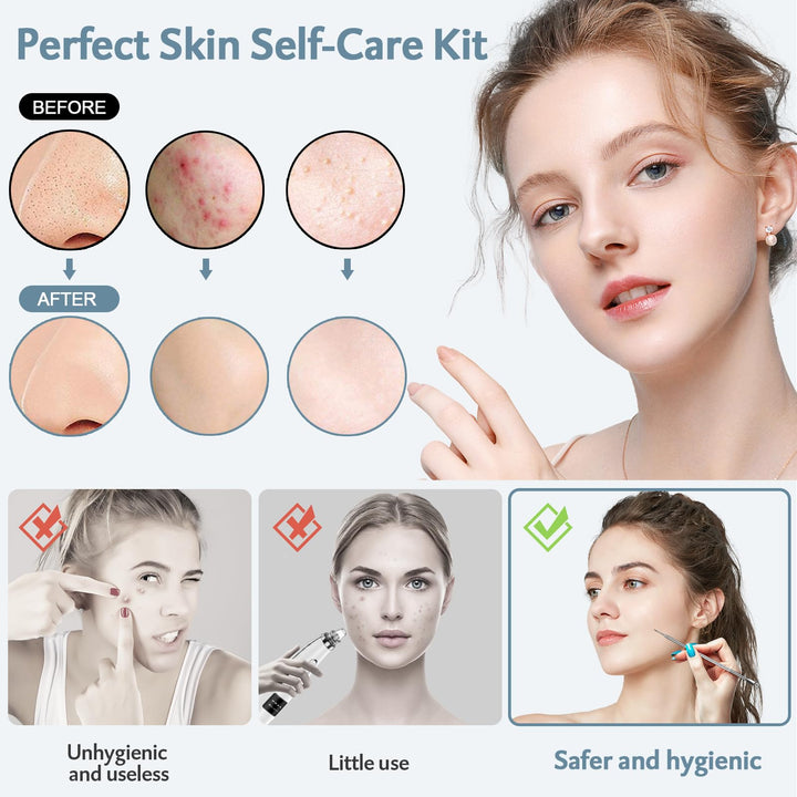 Pimple Popper Tool kit 15 Pcs, Comedone Extractor Blackhead Remover Tool Kit for Whitehead Popping, Stainless Steel Pimple Extractor with Metal Case and 10X Beauty Magnifier
