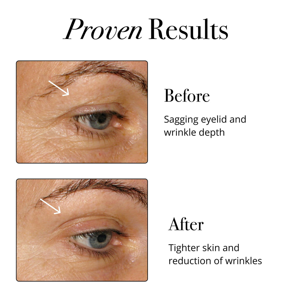 Super Beauty Elixir - Collagen Peptides Powder for Skin, Hair & Nail Health. Natural Grass Fed Collagen with Biotin, Hyaluronic Acid & Antioxidants (30ct)