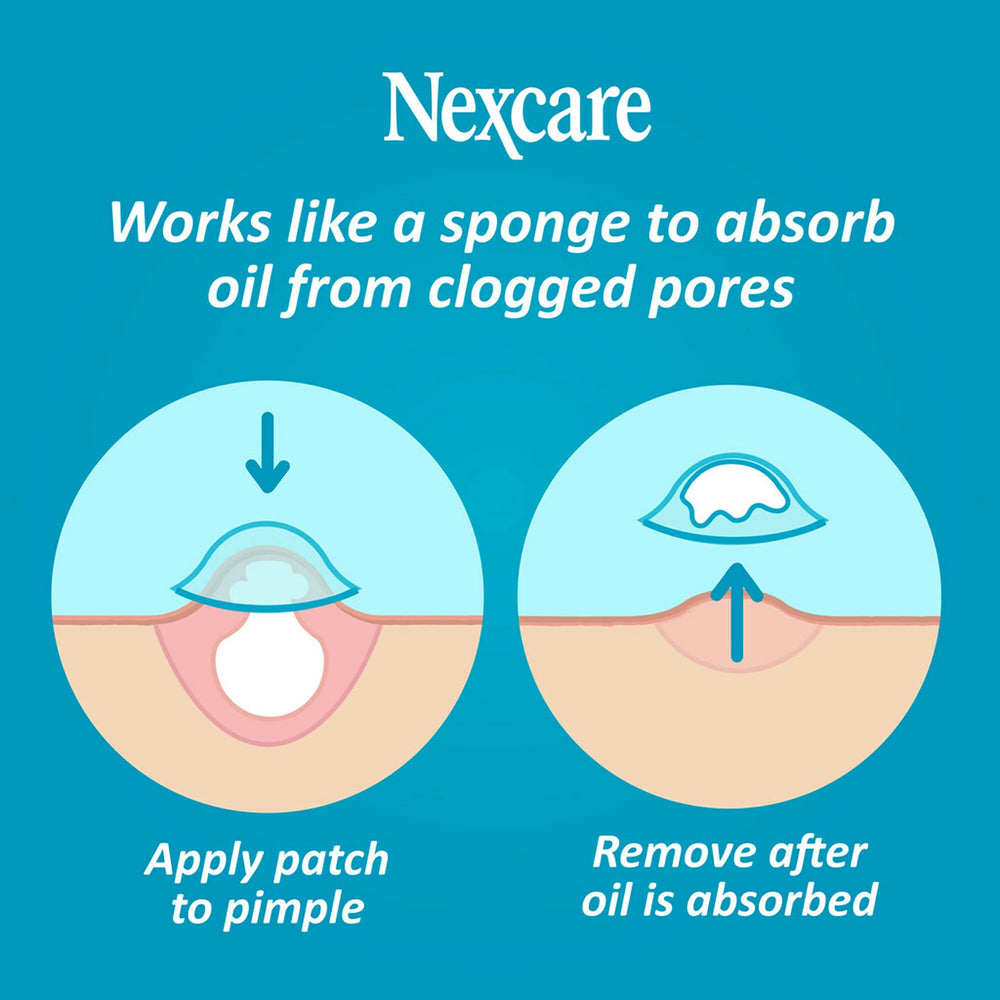 Nexcare Acne Absorbing Cover, Two Sizes, 36 Count