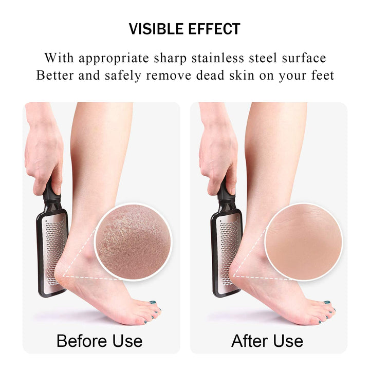 SetSail Foot File Callus Remover Metal Surface Foot Scr