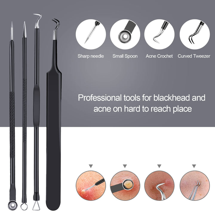 Pimple Popper Tool Kit 10 Pcs, Newest Blackhead Remover Pimple Comedone Extractor Tools for Easy and Fast Removal of Blackheads, Pimples and Blemish on Face, with Elaborate Leather Bag