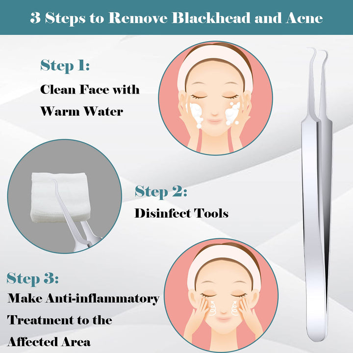 ANCIRS 6 Pack Acne Pimple Blackhead Remover Tweezers, S