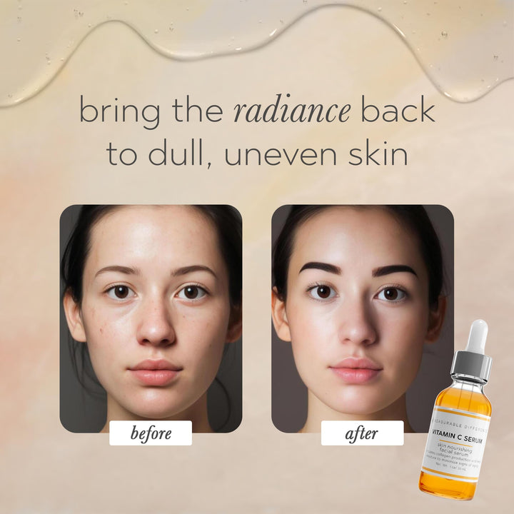 Vitamin C Serum for face, 1 oz - Moisturize Skin to Minimize Signs of Aging, face serums for anti aging | Provide Smooth &amp; Even Complexion with a Radiant Glow | vit c serum face