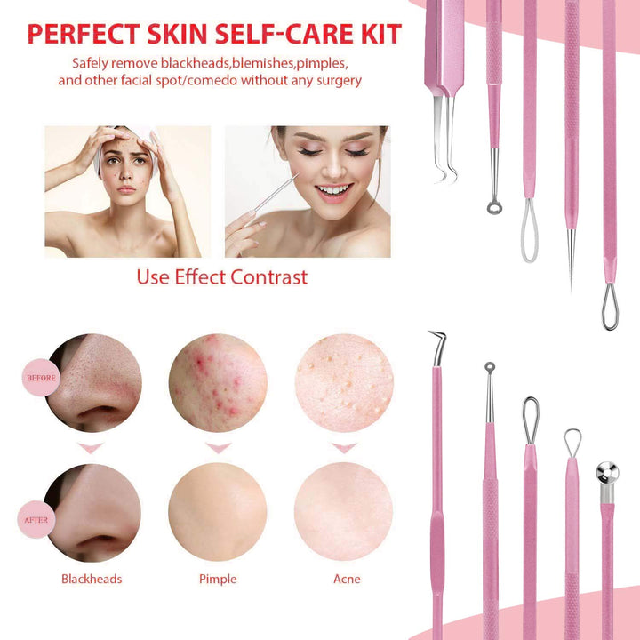Blackhead Remover Tool, 10Pcs Professional Pimple Popper Tool Kit - Easy Removal for Whitehead Popping, Zit Removing for Risk Free Nose Face, Anti-Slip Coating Handle(Pink)
