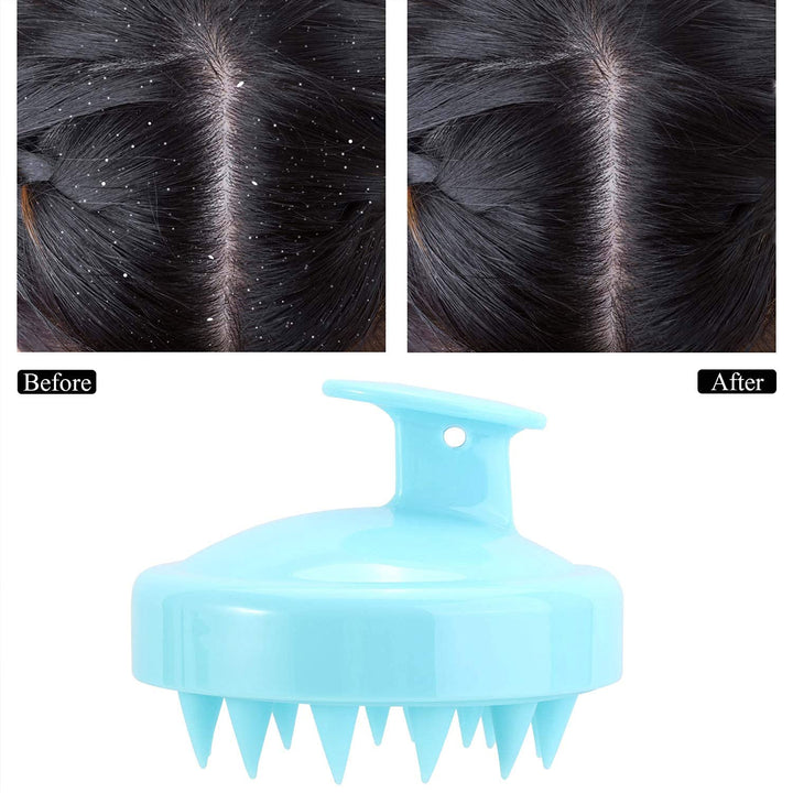 2pcs Silicone Shampoo Brush Scalp Exfoliator Brush for Scalp Scrubber Dandruff Remove, White Green