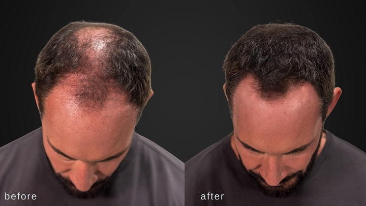 LUXE Hair Thickening Fibers - CONFIDENCE IN A JAR – 2 M