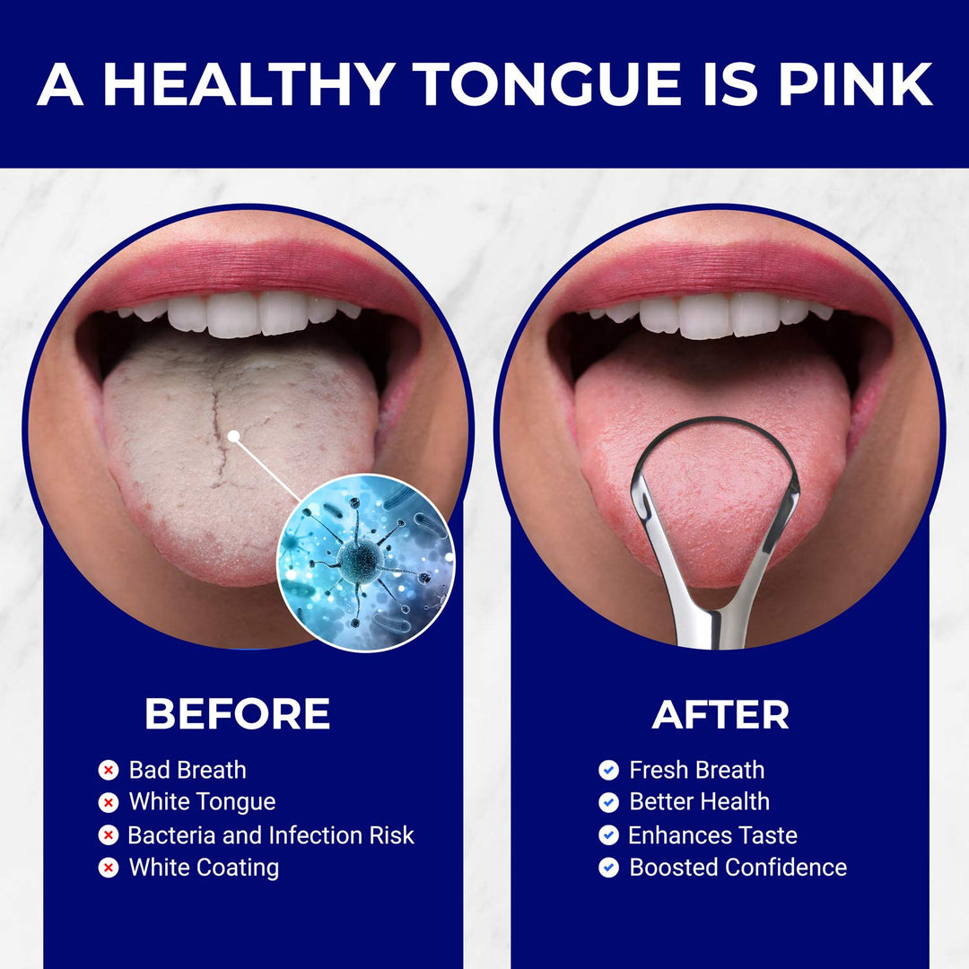 Tongue Scraper Stainless Steel | Bad Breath Treatment |