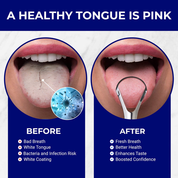 Tongue Scraper Stainless Steel | Bad Breath Treatment |