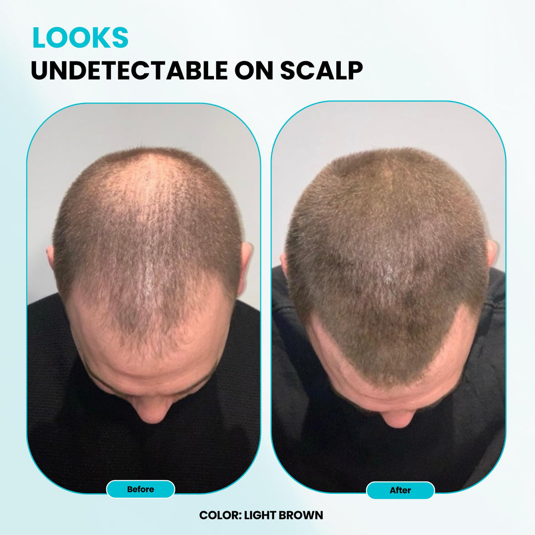 Hair Thickening Fibers - 30g - Natural - High Performance Hair Loss Concealer - Does Not Run When Wet (Medium Brown)