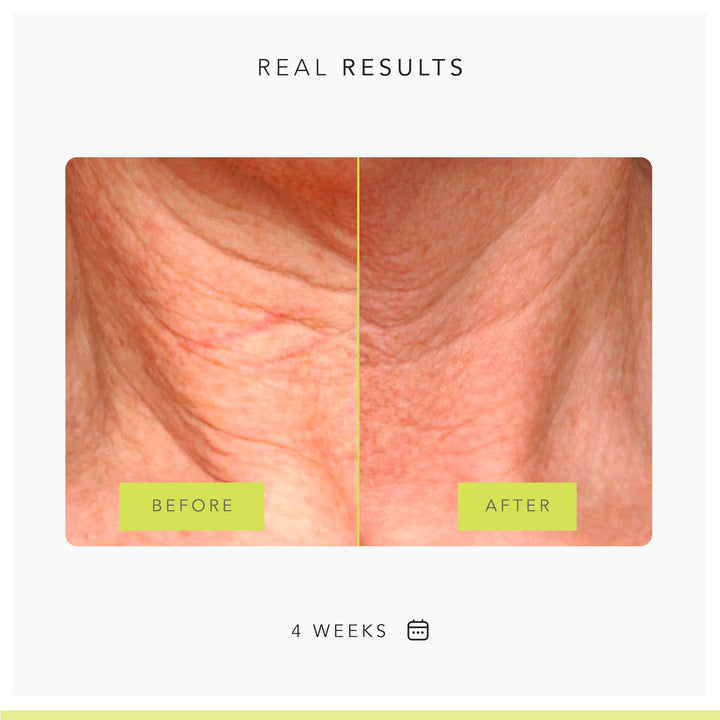 Stem Cellular Neck Lifting Cream - 1.7 oz