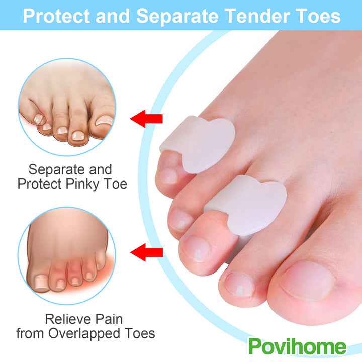 Povihome 10 Pack Pinky Toe Separators, Toe Spacers to S