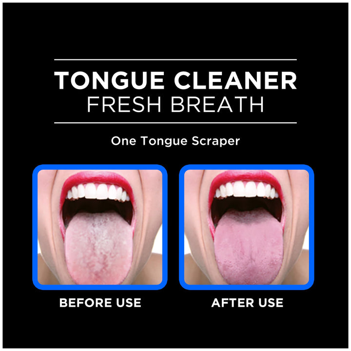 Tongue Cleaner Helps Fight Bad Breath, 1 Count (Pack of 2)