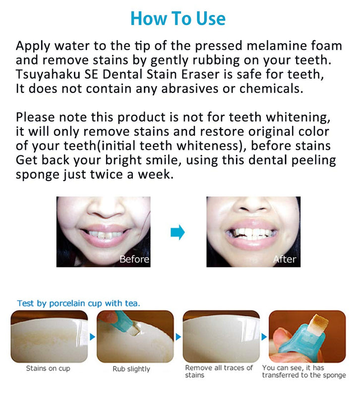 Tsuyahaku Se Dental Stain Eraser Handle X1 (Turqoise) + Refill Sponges 11 Count - 100% Safe And Easy Tooth Stain Removal/Whitening At Home (100% Made In Japan) ‚¬¦
