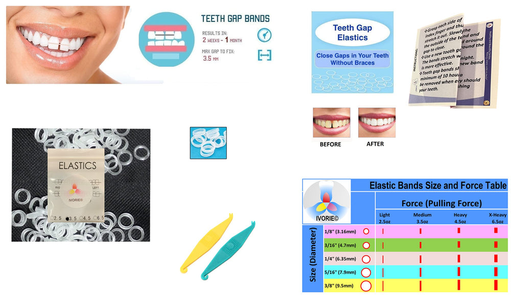IVORIE Dental Teeth Gap Orthodontic Bands Clear Elastic