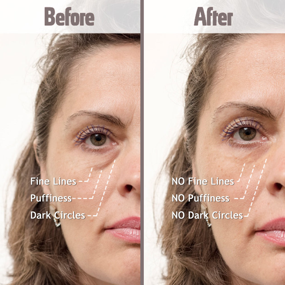 Puffy Eye Treatment Instant results – Naturally Eliminate Wrinkles, Puffiness, Dark Circle and Bags in Minutes – Hydrating Eye Cream w/ Green Tea Extract, Dead Sea Minerals – .8 fl.oz.