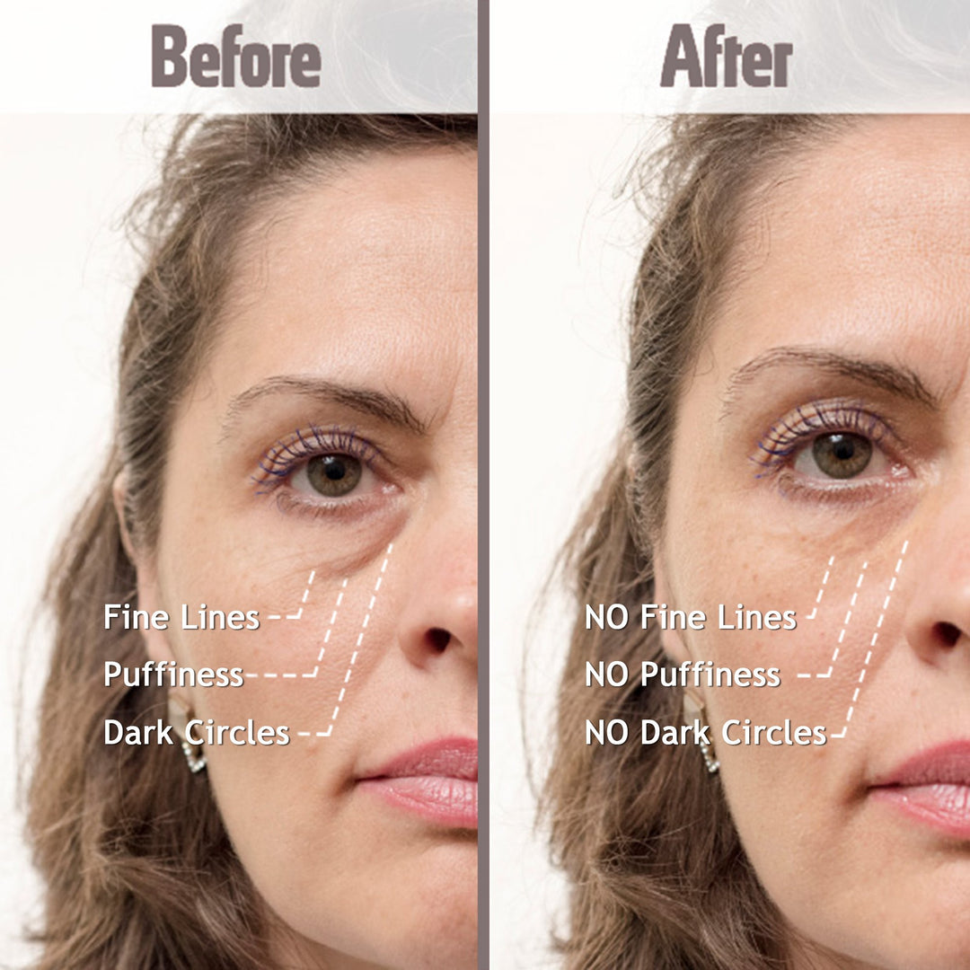 Puffy Eye Treatment Instant results – Naturally Eliminate Wrinkles, Puffiness, Dark Circle and Bags in Minutes – Hydrating Eye Cream w/ Green Tea Extract, Dead Sea Minerals – .8 fl.oz.