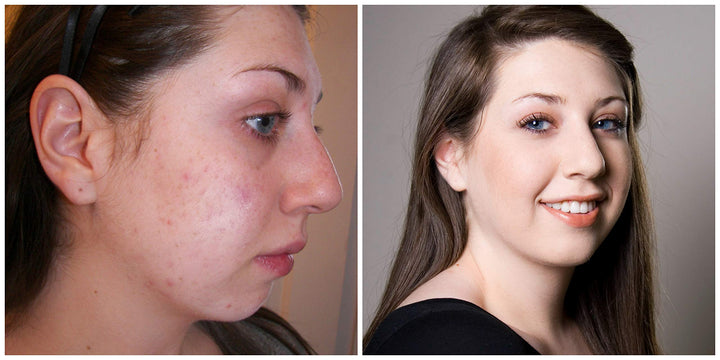 The Everything Pencil Erase Zit- Neutral