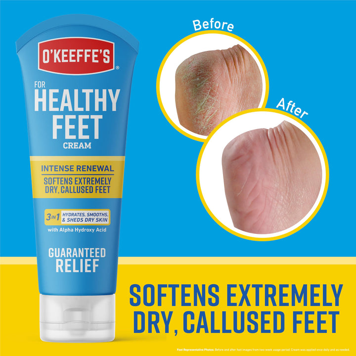 O&#39;Keeffe&#39;s Healthy Feet Intense Renewal Cream with Alpha Hydroxy Acid; Softens and Exfoliates Extremely Dry; Callused Feet; 3oz Tube (Pack of 1)