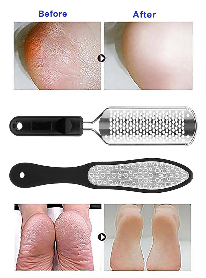 BS-MALL 2PCS Professional Pedicure Rasp Foot File Cracked Skin Corns Callus Remover for Extra Smooth and Beauty Foot