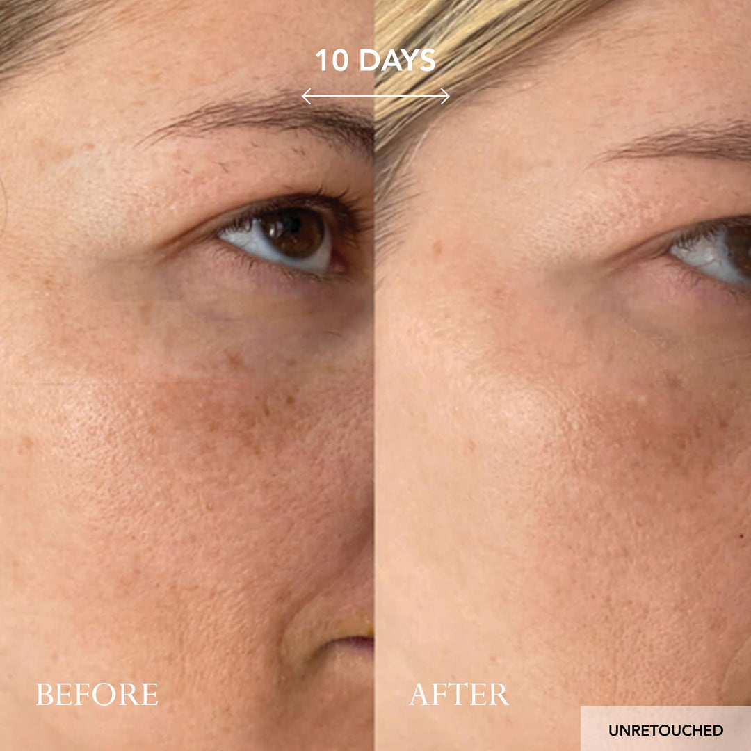 Kat Burki Vitamin C Intensive Day Cream, 1.7 oz.