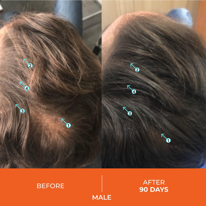 Revita Stimulating Shampoo,180ml &#39;Pack of 2&#39;