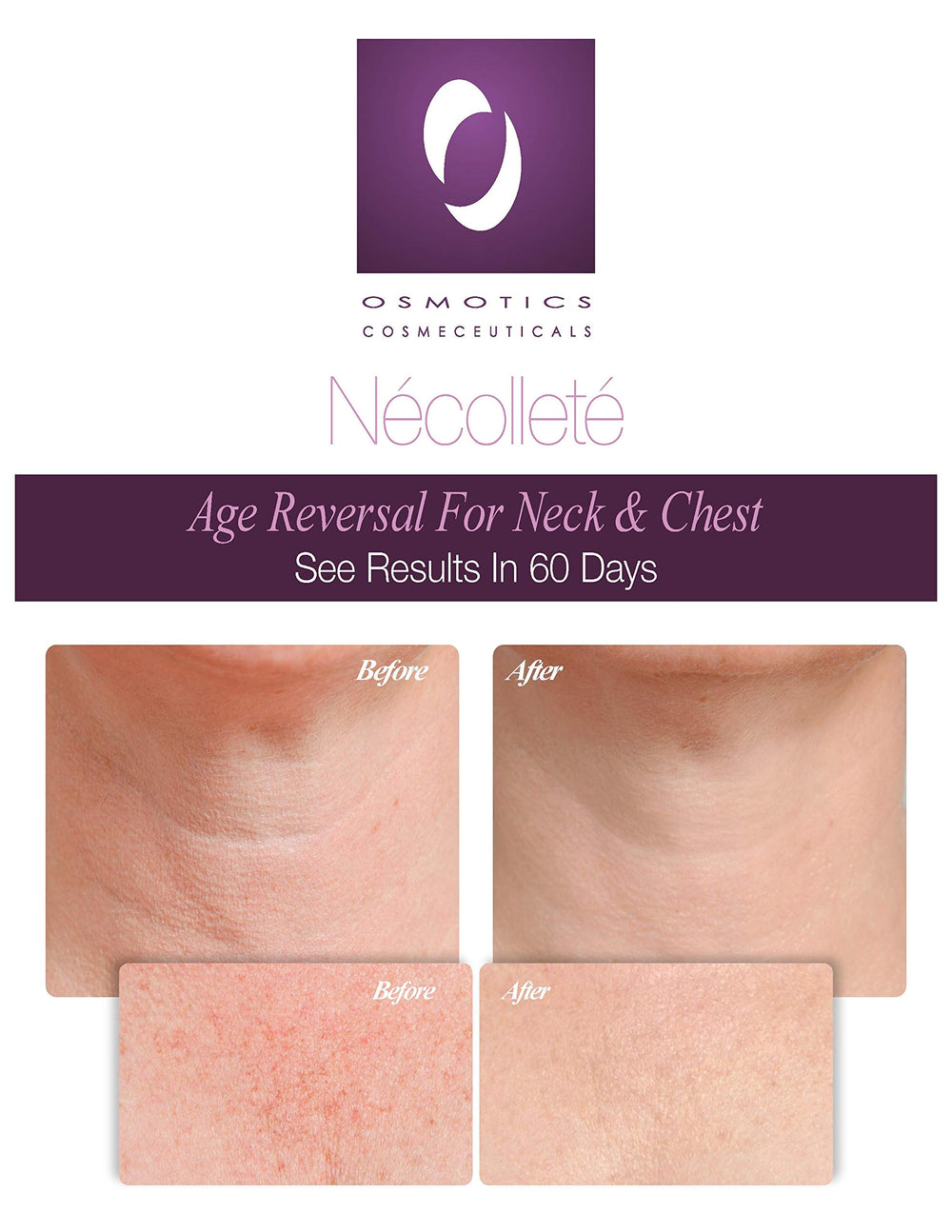 Necollete Age Reversal For Neck and Chest, 1.7 Oz