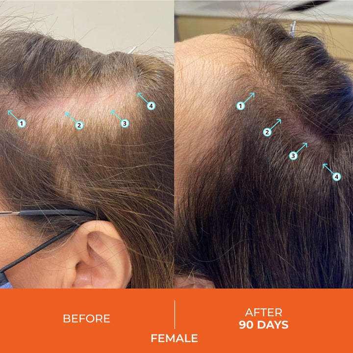 Revita Stimulating Shampoo,180ml &#39;Pack of 2&#39;