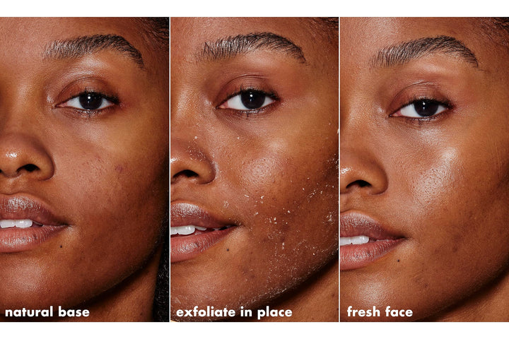 SKIN Gentle Peeling Exfoliant, Cleanser, Effective, Easy to Apply, Peels Away Dead Skin, Removes Dirt, Ideal for All Skin Types