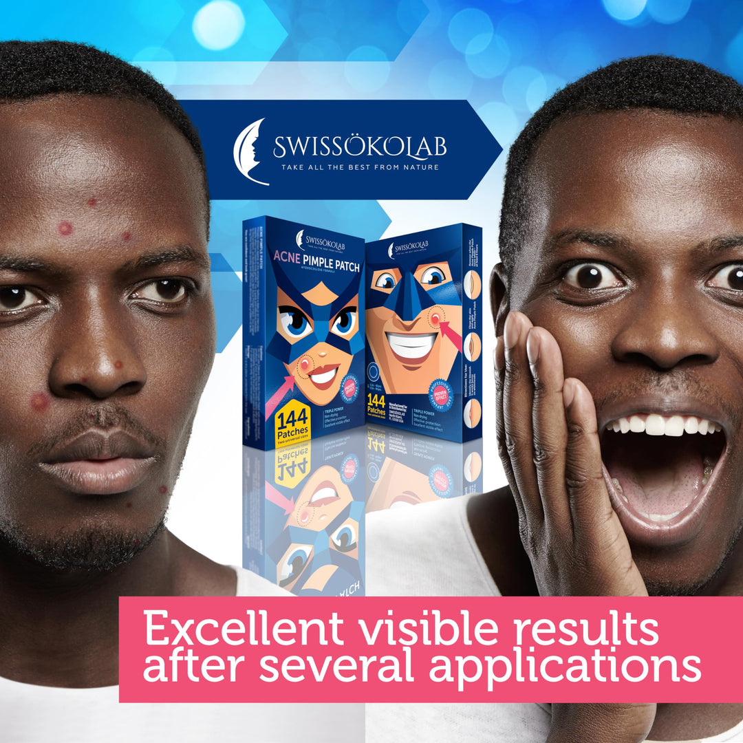 Sakura Skin Acne Patch Pimple Patch Hydrocolloid Acne Stickers Absorbing Spot Dot Acne Cover 72 Acne Dots Pimple Sticker Acne Pimple Master Patch Blemish Patches