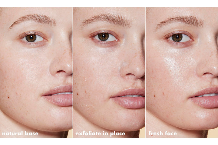 SKIN Gentle Peeling Exfoliant, Cleanser, Effective, Easy to Apply, Peels Away Dead Skin, Removes Dirt, Ideal for All Skin Types